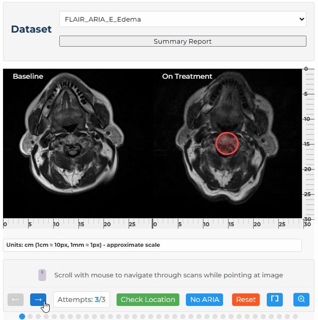spot-the-aria-demo